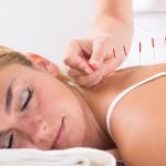 Acupuncture for back pain